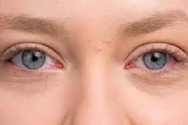 कम उम्र में बढ़ रही आंखों की बीमारियां: डिजिटल लाइफस्टाइल और एसी बन रहे ड्राई आइज की बड़ी वजह उम्र