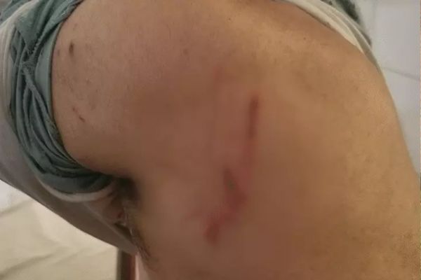 पत्नी पर पालतू कुत्ते से हमला करवाने का आरोप, पति गंभीर रूप से घायल पालतू